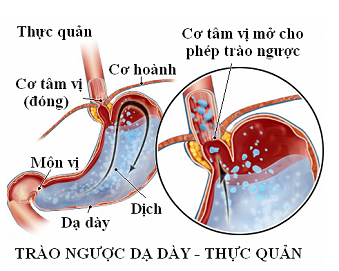 trao nguoc da day thuc quan