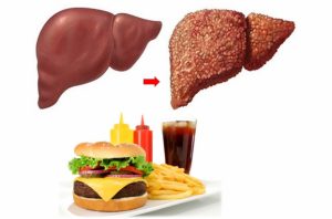 Những loại thực phẩm có thể gây hại cho gan